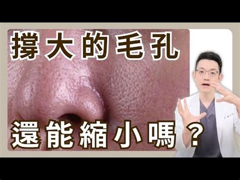 臉上長白毛可以拔嗎